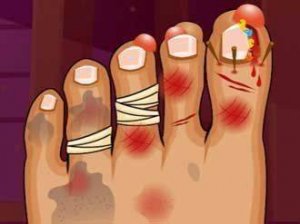 Monster Foot Care Game - Medical Care Game